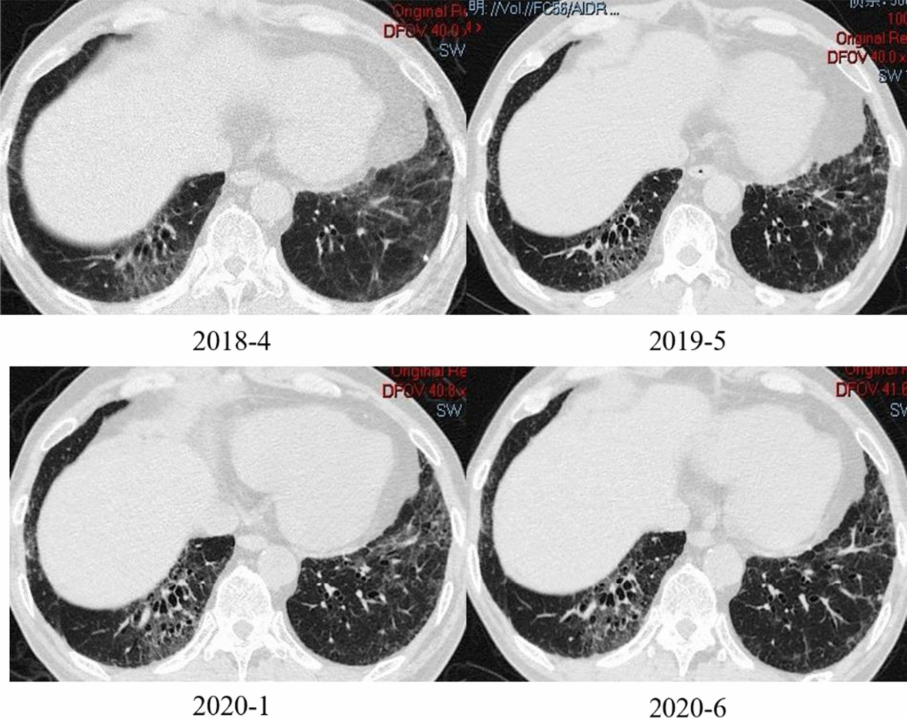 Fig. 3