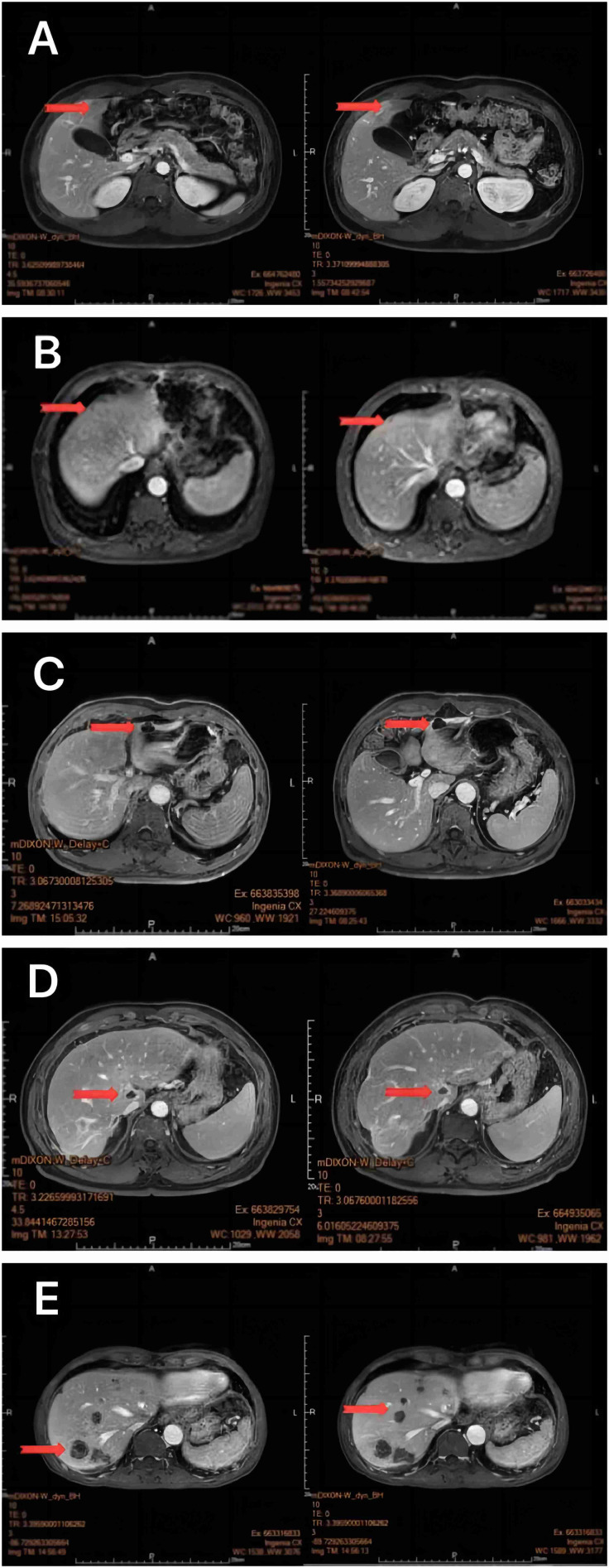 Figure 3