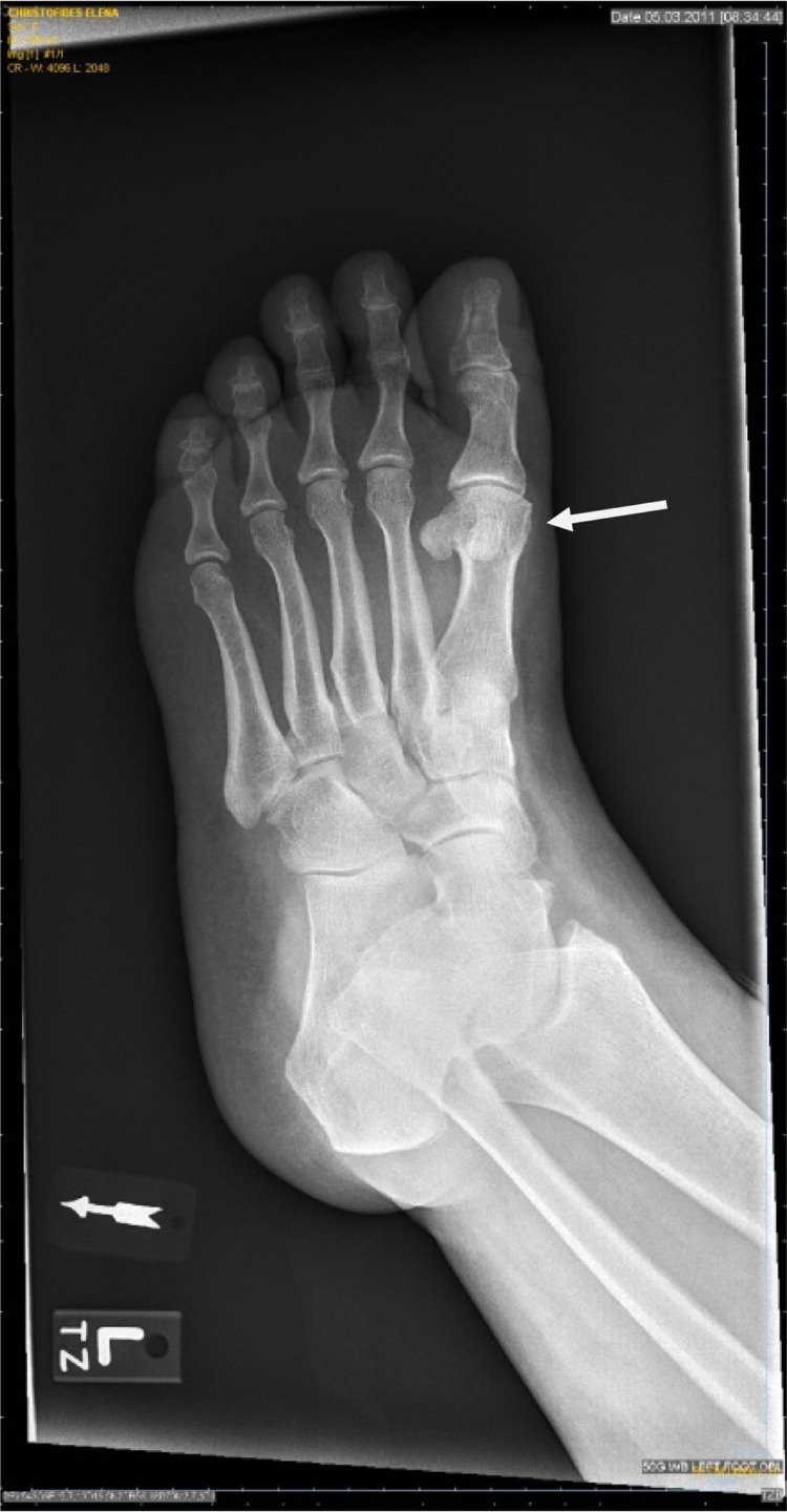 Figure 4