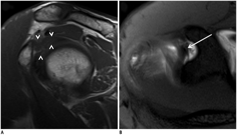 Fig. 17