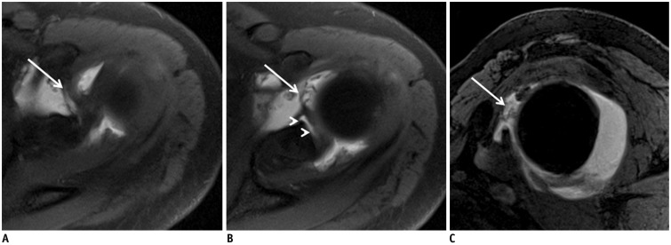 Fig. 18