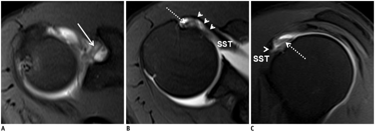 Fig. 15