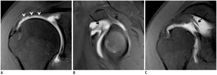 Fig. 12