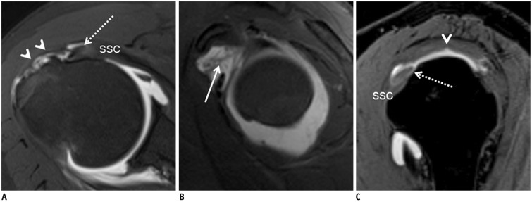 Fig. 14