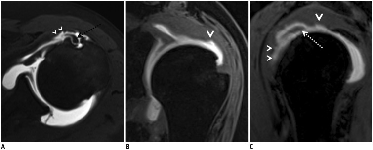 Fig. 16