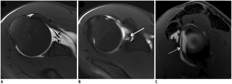 Fig. 19