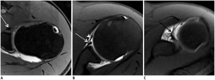 Fig. 20