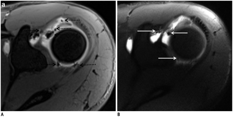 Fig. 21