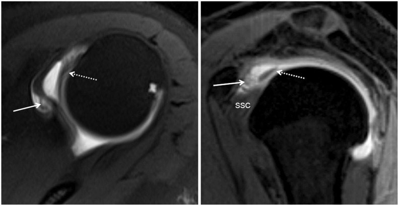 Fig. 13