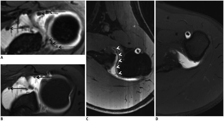 Fig. 22