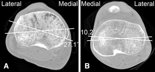 Fig. 7A–B