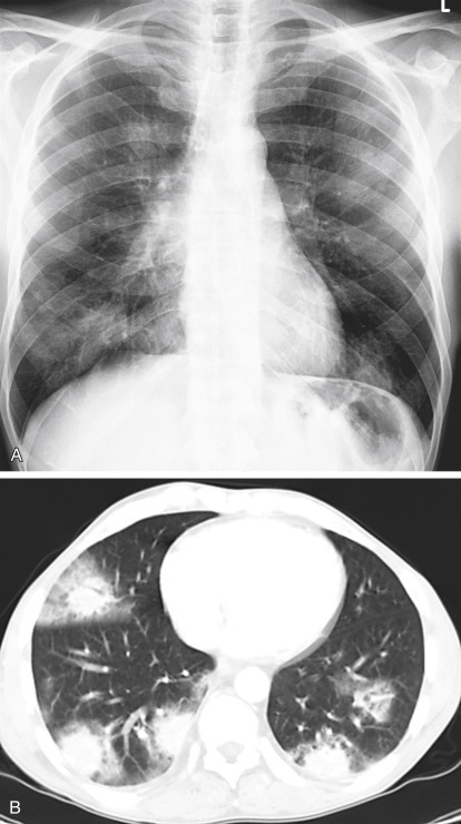 Fig. 16.10