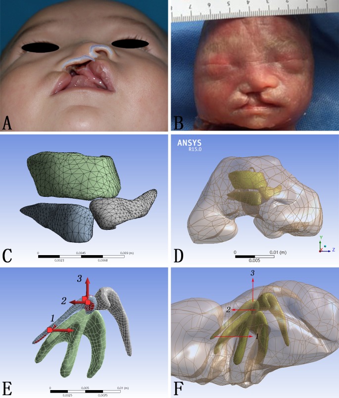 Fig 1