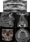Fig. 15
