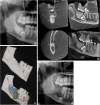 Fig. 11