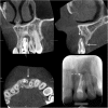 Fig. 14