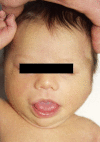 Fig. 2