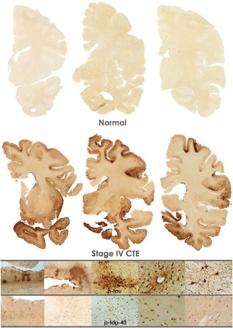 Fig. 4.4