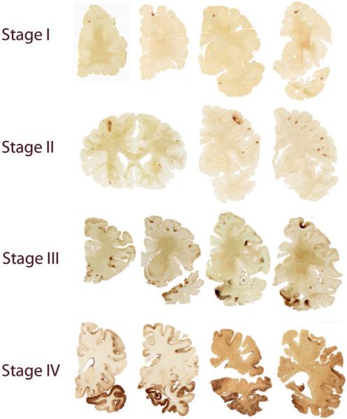 Fig. 4.3