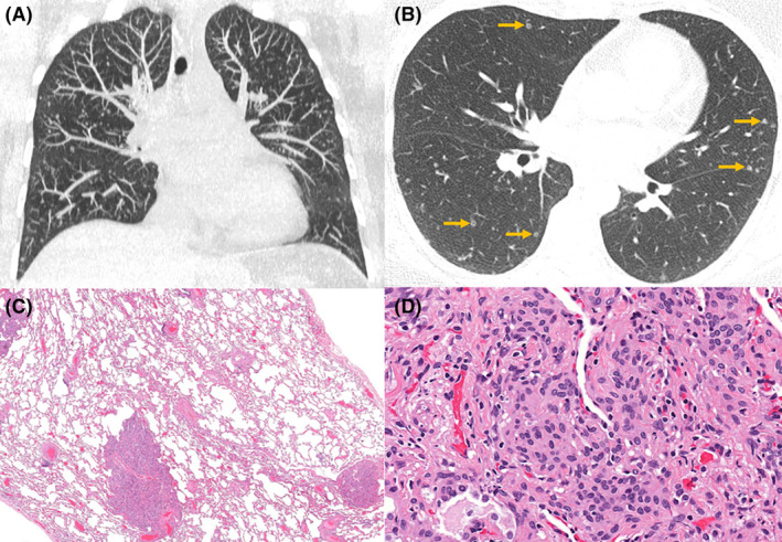 FIGURE 1