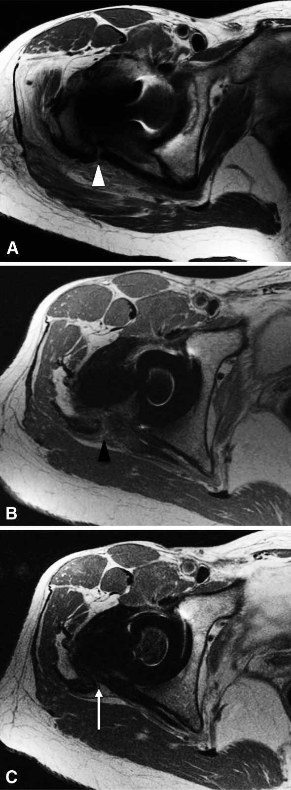 Fig. 1A–C