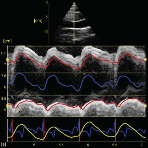 Fig. 1.