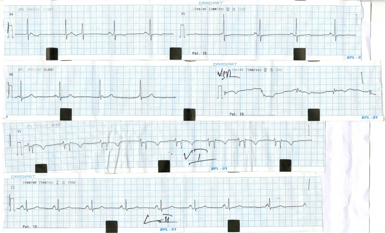 Fig. 6