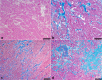 Fig. 12