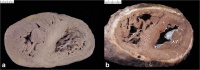 Fig. 10