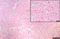 Fig. 11