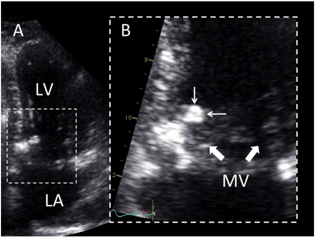 Fig. 1