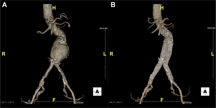 Fig 2