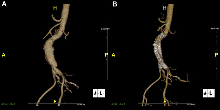 Fig 4