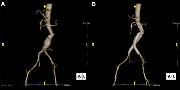 Fig 3