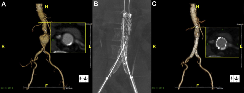 Fig 1