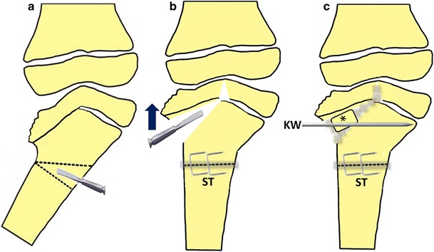 Fig. 3