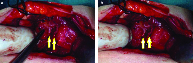 Figure 1. a,b