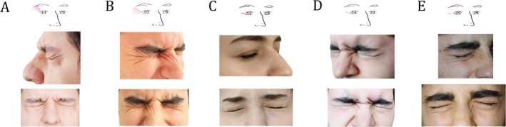FIGURE 4
