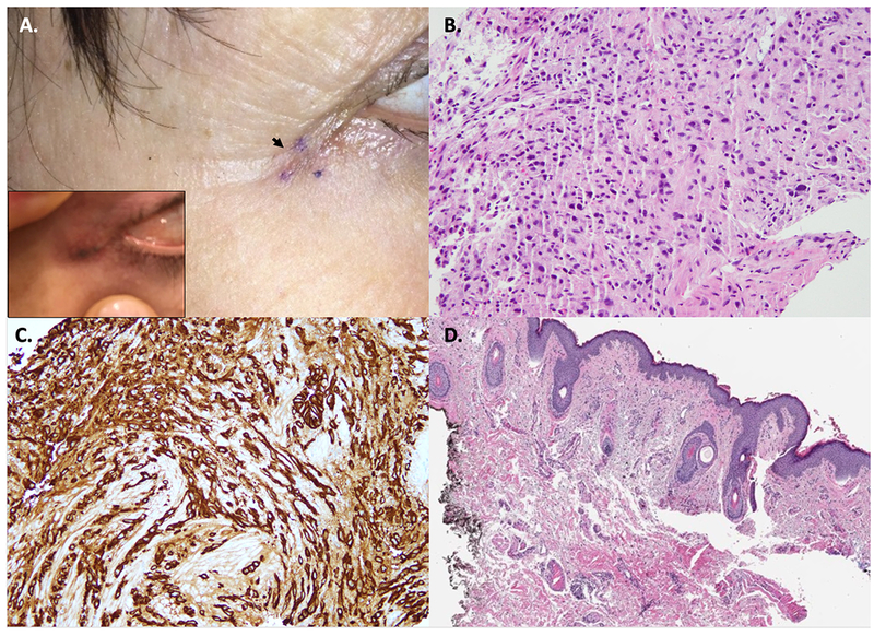 Figure 1: