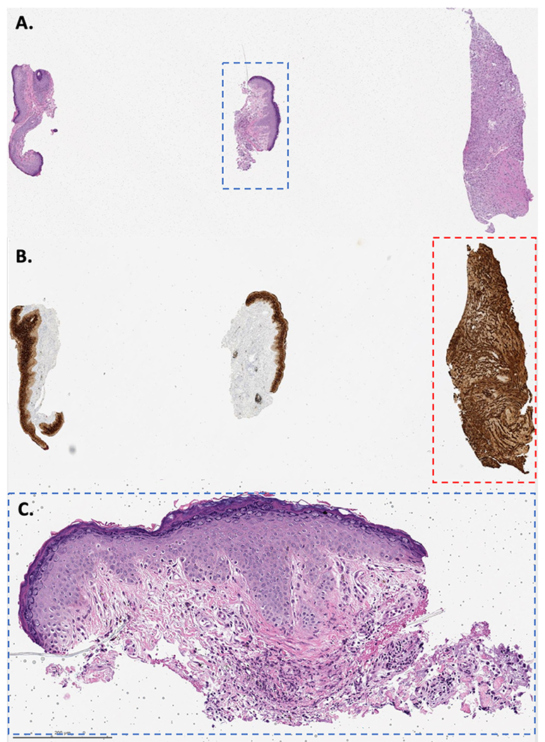 Figure 2: