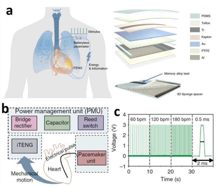 Figure 35