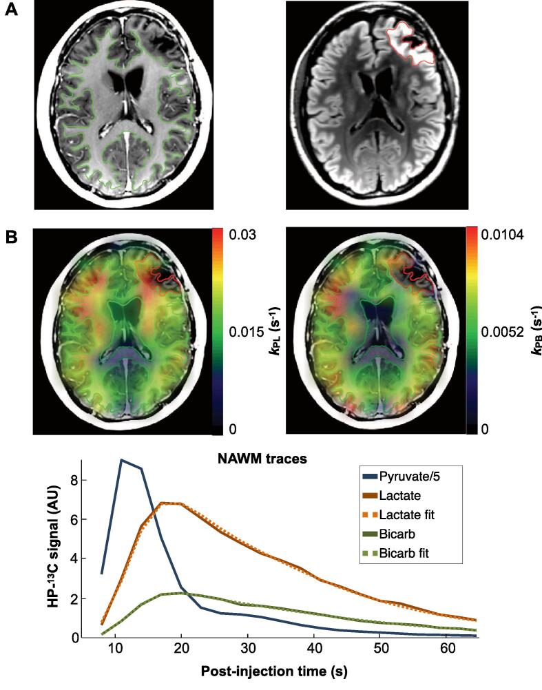 Fig. 2