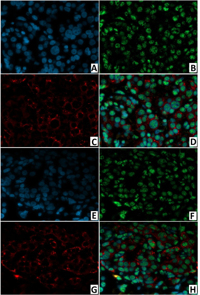 Figure 14