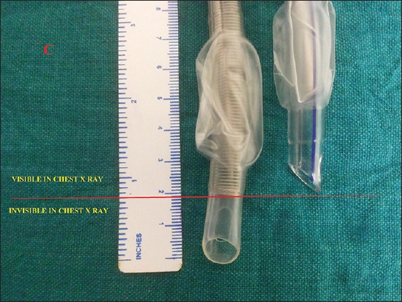 Armored Endotracheal Tube: Concerns in Intensive Care Unit - PMC