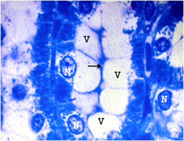 Figure 18