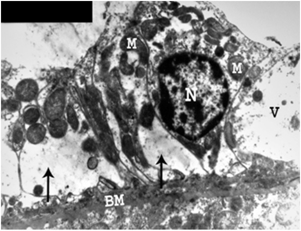 Figure 22