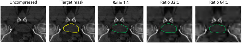 Fig. 12