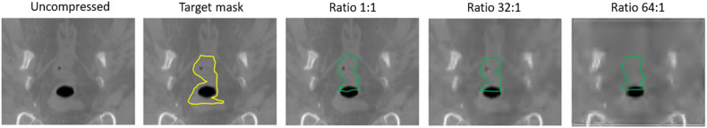 Fig. 13