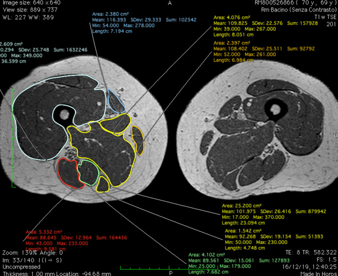 Fig. 4