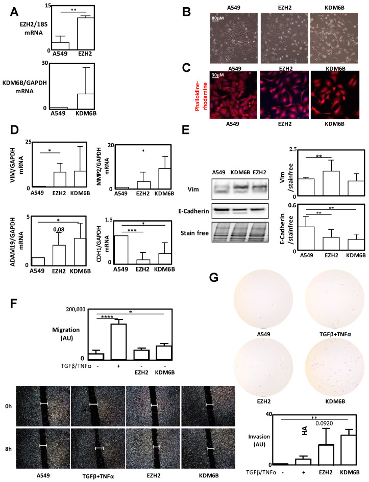 EZH2 and KDM6B Expressions Are Associated with Specific Epigenetic ...